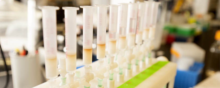 Close up view of milk samples in tubes for analysis in a microbiology lab - One Health UC Davis