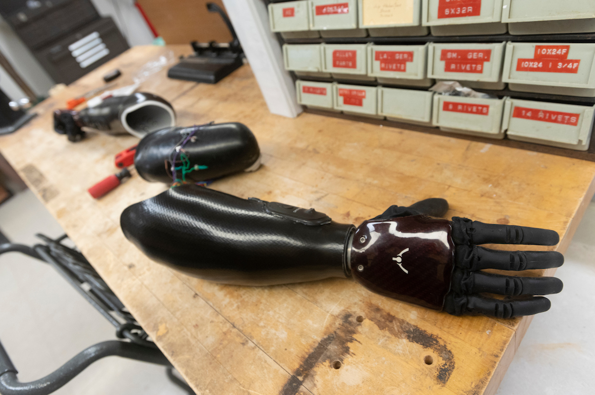 A newer myoelectric prosthetic hand sits on a table. It has a long black sleeve with a bionic hand, which looks like a glove. The hand has five fingers that can move independently.
