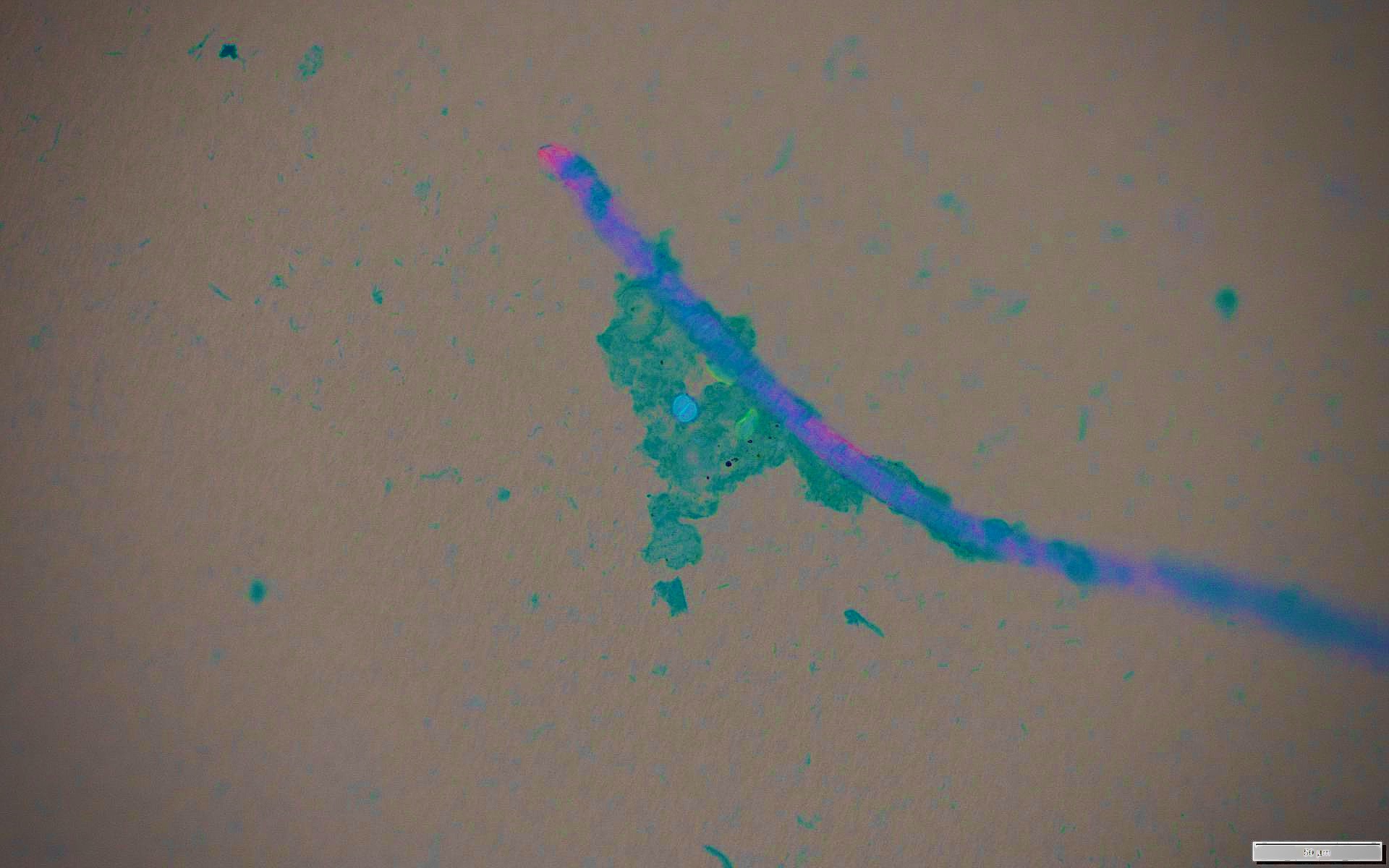 Microscopic view of blue microplastic fiber on beige background with greenish-blue dots showing pathogens 