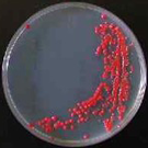 Yeast culture in petri dish