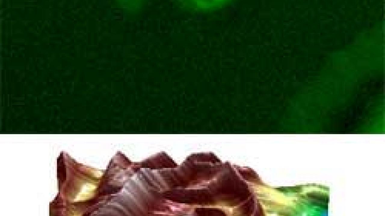 Mast cells caught in the act of starting an allergic reaction. The new confocal/AFM microscope shows both an entire cell (green image), above, and details of the cell surface, below. The images produced by one of the most advanced microscopes of