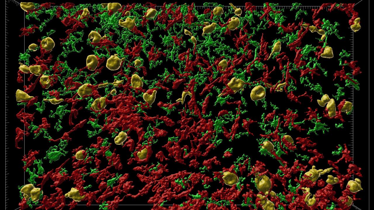 3D image of brain cells