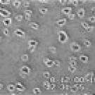 Photo: amoeba photographed under a microscope