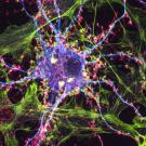 Colored image of nerve cells. 