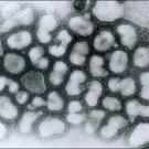 Electron micrograph photo of flu virus 