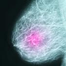 Mammogram of breast with pink spot